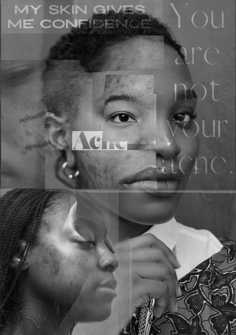 Holly Christie, 12469-2991942_b0ab1fe, you are not your acne - degree show poster